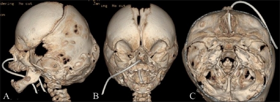 Figure 14(A-C)