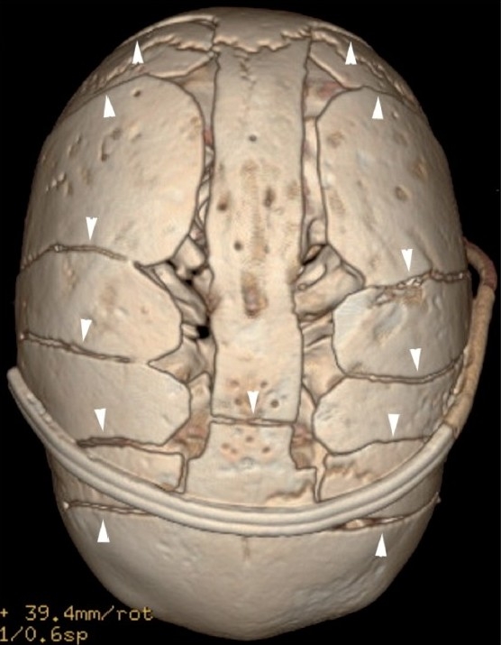 Figure 15