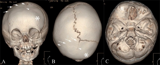 Figure 4(A-C)