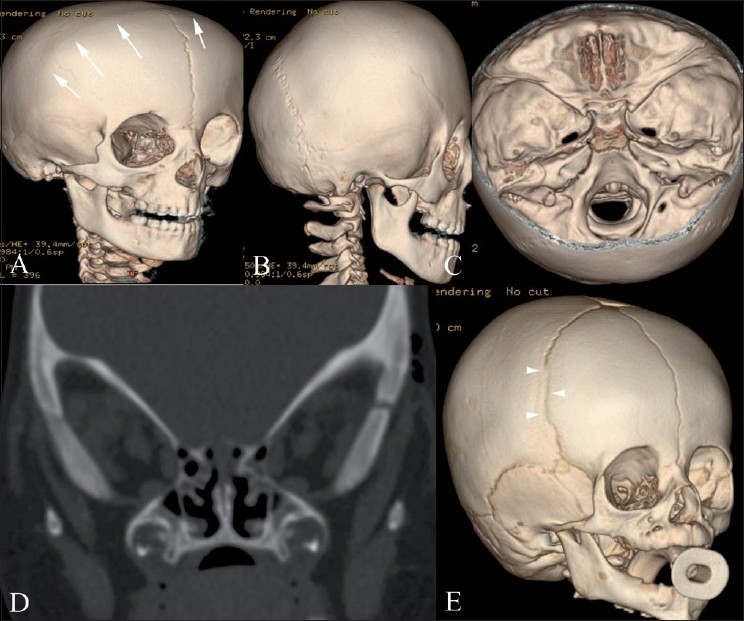 Figure 3(A-E)