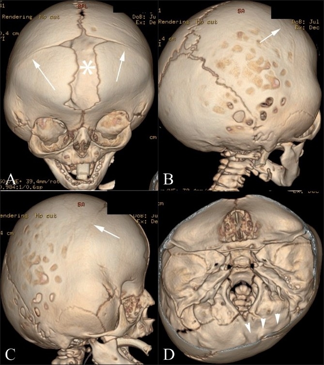 Figure 13(A-D)