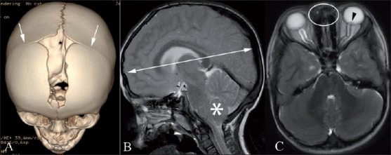 Figure 12(A-C)