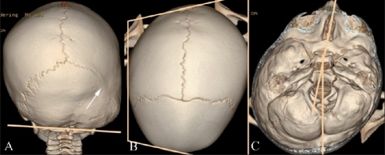 Figure 6(A-C)