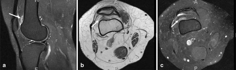 Fig. 19