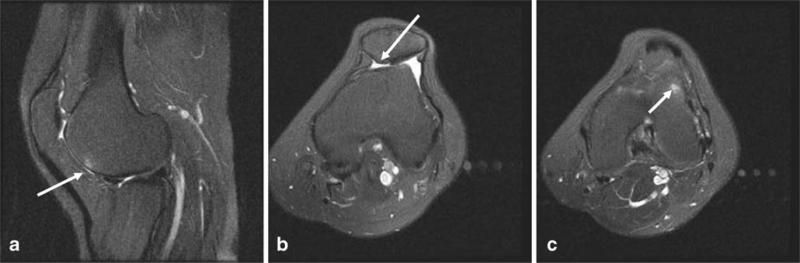 Fig. 16