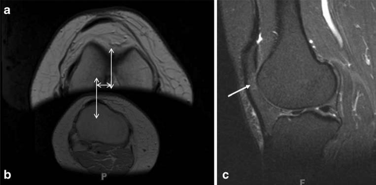 Fig. 10