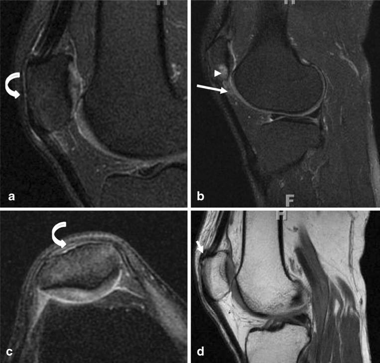 Fig. 12