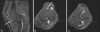 Fig. 16