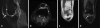 Fig. 17