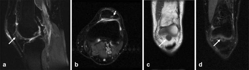 Fig. 17