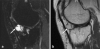 Fig. 18