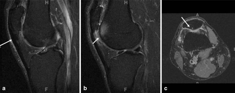 Fig. 14