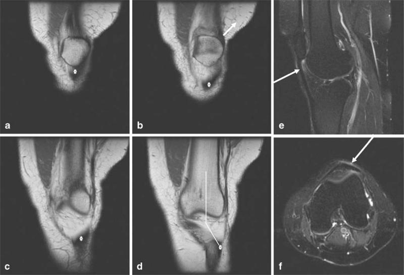 Fig. 11