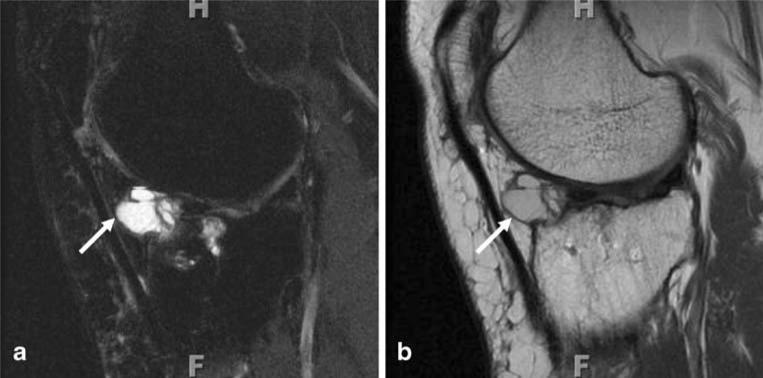 Fig. 18