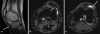Fig. 15