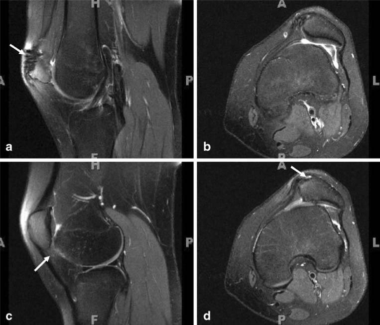 Fig. 13