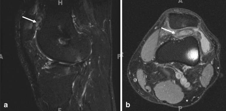 Fig. 20