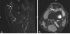 Fig. 20