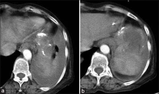 Figure 15