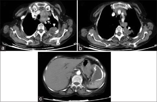 Figure 26