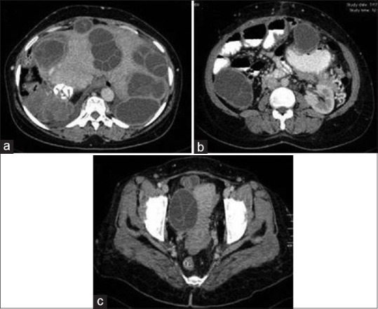 Figure 19