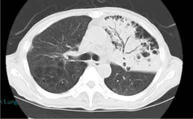 Fig. 5