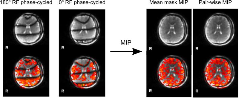 FIG. 4