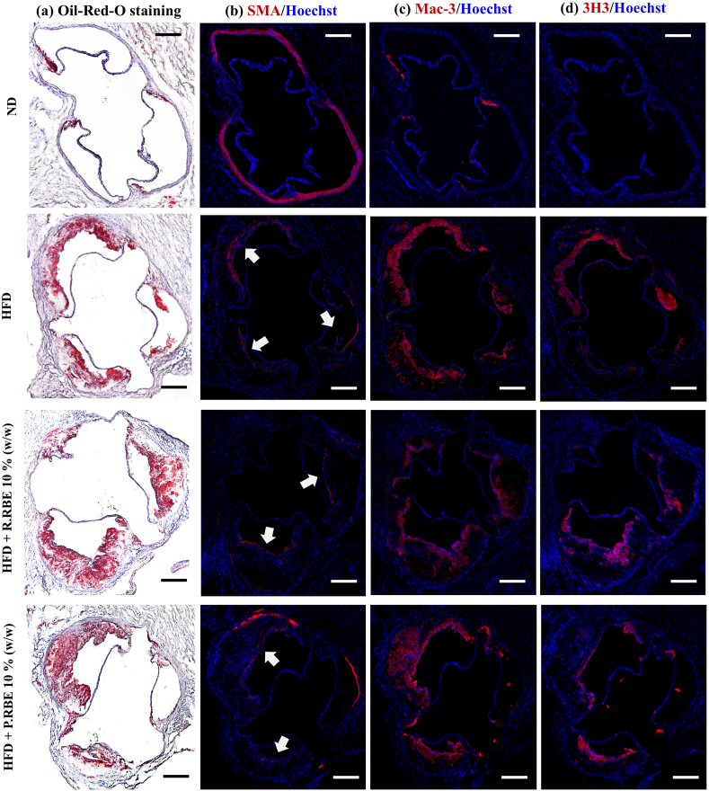 Figure 11