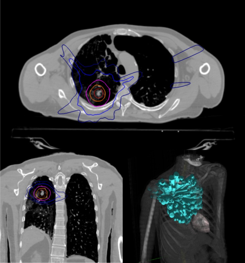 Fig. 2.