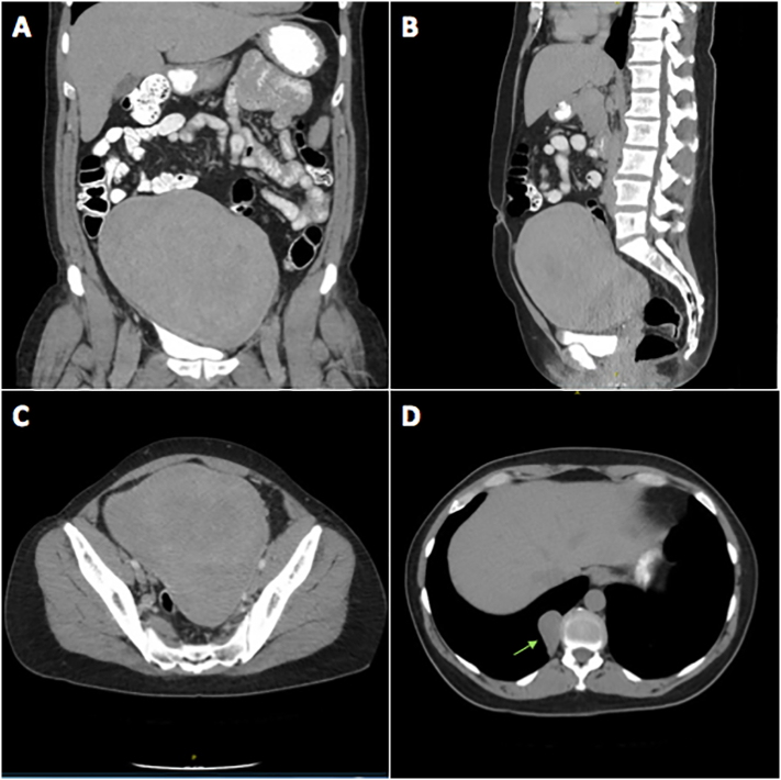 Fig. 2