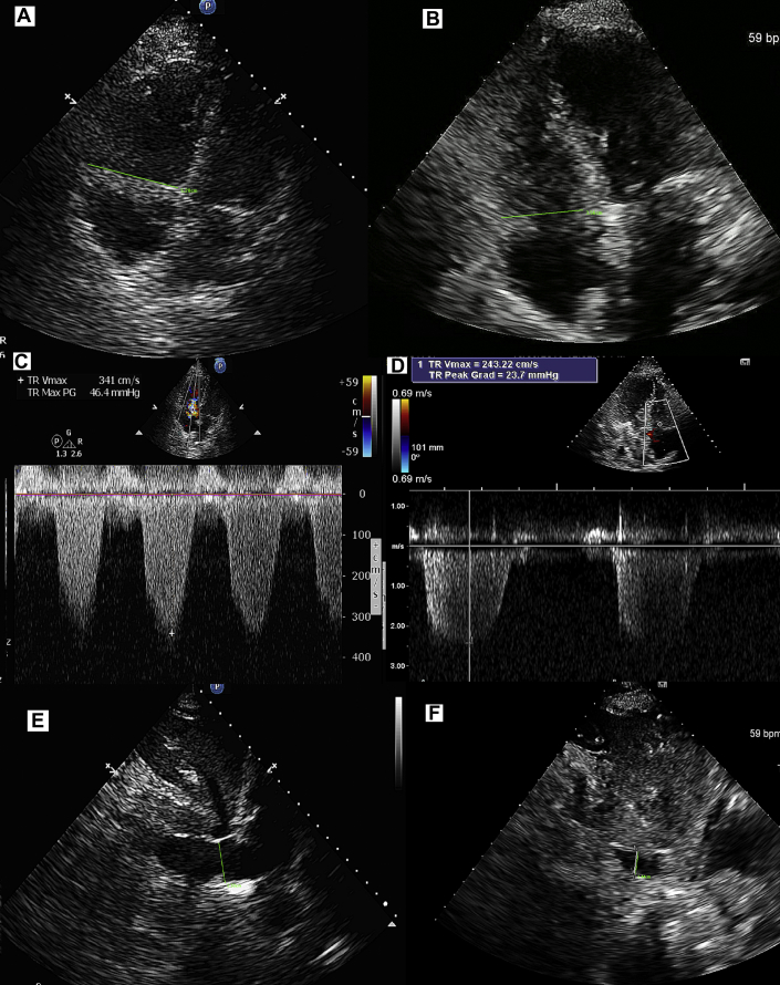 Figure 3