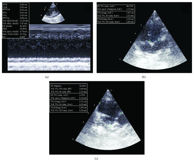 Figure 4