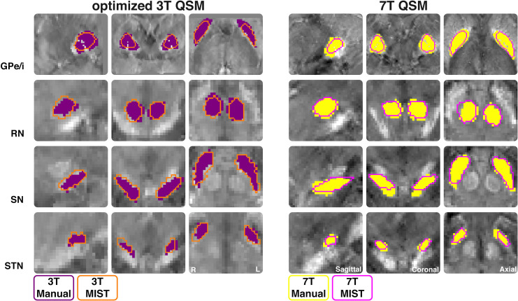 Fig 4