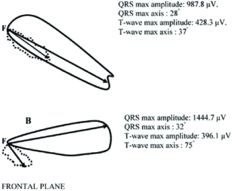 Fig. (2)