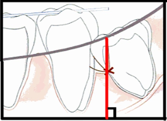Fig. 2