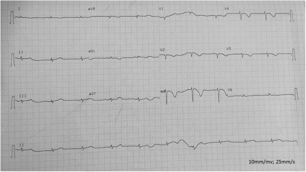 Figure 4