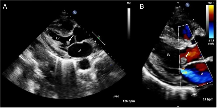 Figure 5