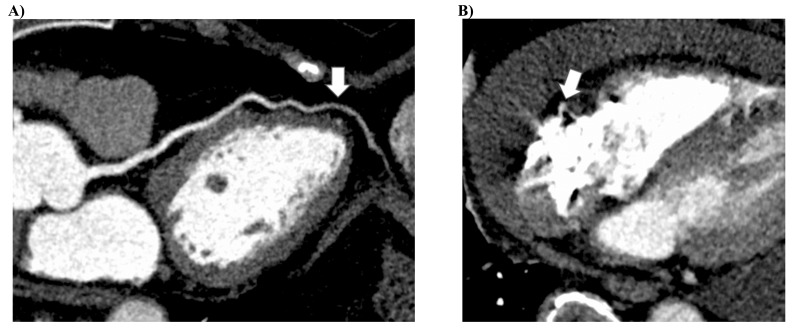 Fig. (2)