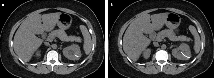 Figure 2. a, b.