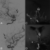 Fig 4.
