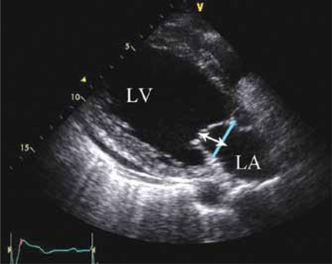 Figure 13