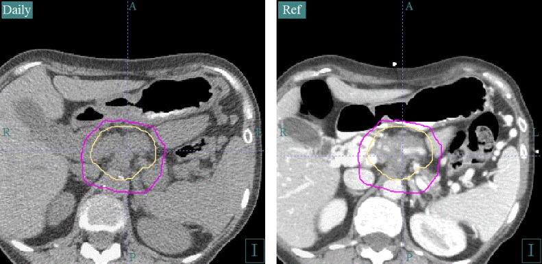 Fig. 2.