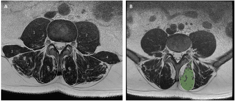 Figure 1a-b -