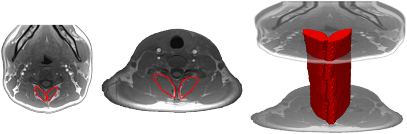 Figure 2 -