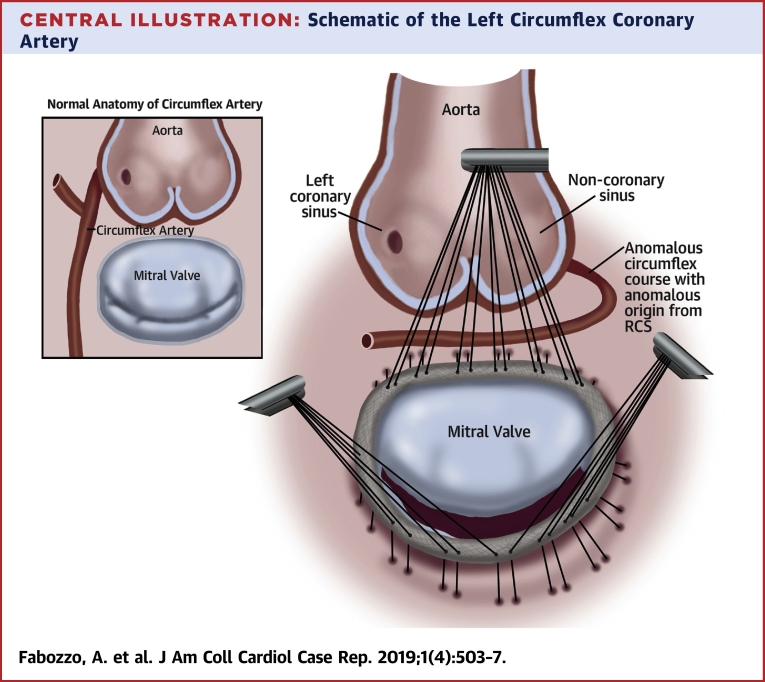 Central Illustration