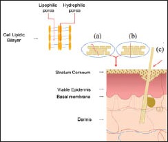 Figure 1b