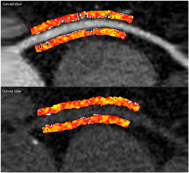 Fig. 2