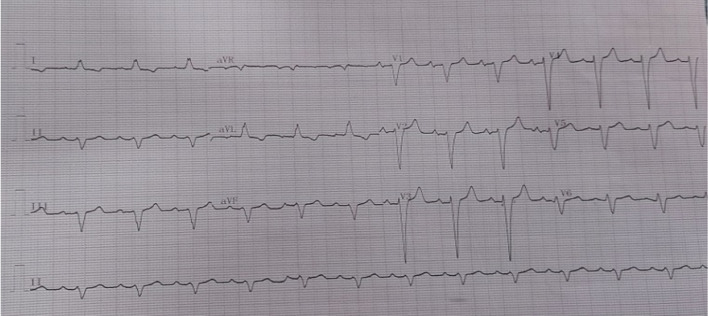 Fig. 2