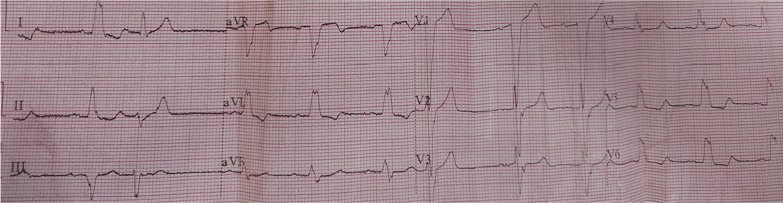 Fig. 1