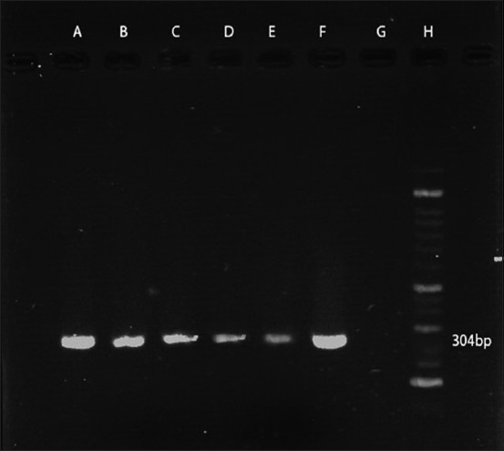 Figure-4